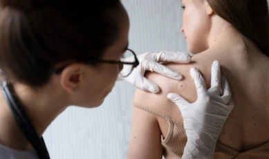 Layanan Kami Kulit dan Kelamin Dermatologi dan Venereologi